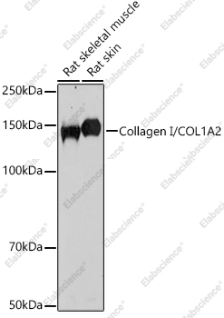 Вестерн-блоттинг, Collagen I/COL1A2, различные клеточные линии