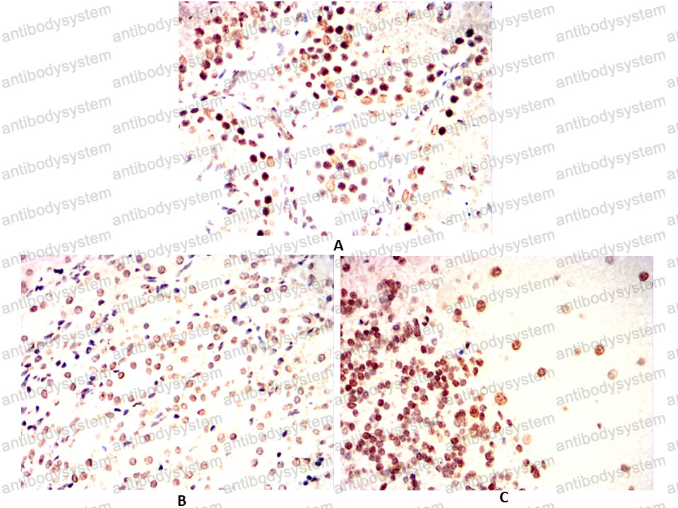 Валидация AntibodySystem RHC03209
