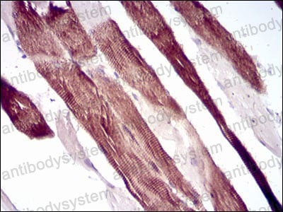 Валидация AntibodySystem RHC39902 (998)