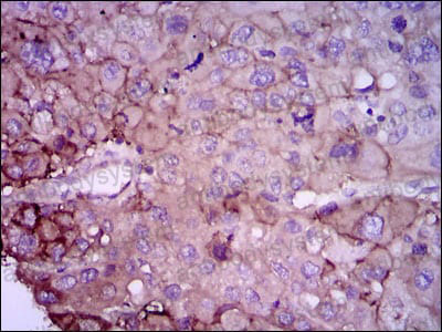 Валидация AntibodySystem RHD39201