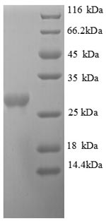 SDS-PAGE