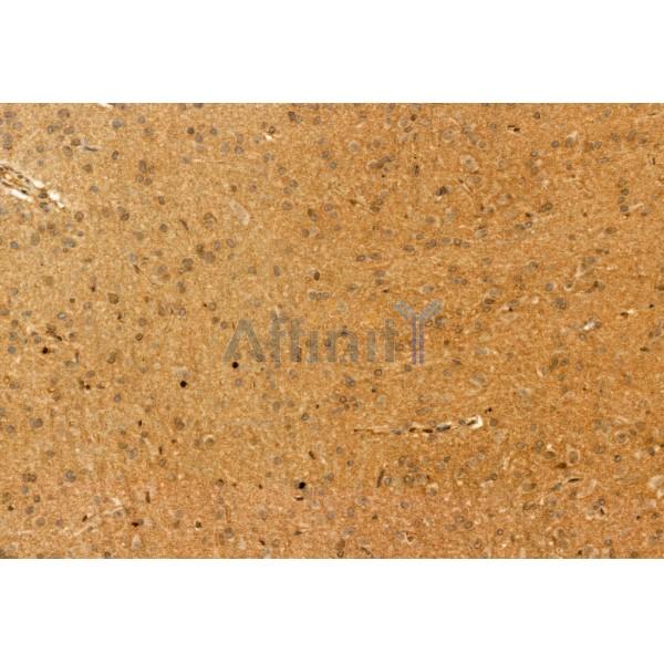 Валидация Affinity DF12097 - 6209