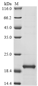 SDS-PAGE