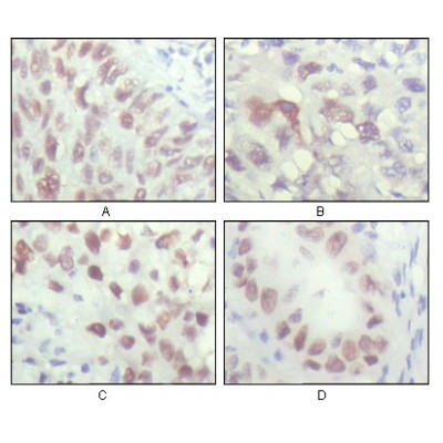 Валидация Affinity BF0577 - 5304