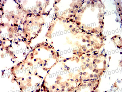 Валидация AntibodySystem RHG13208 (2856)