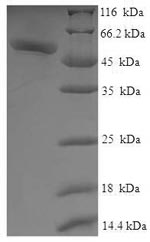SDS-PAGE