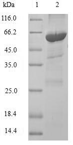 SDS-PAGE