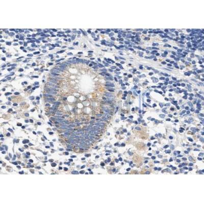 Валидация Affinity AF5174 - 2595