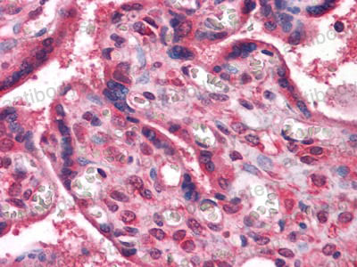 Валидация AntibodySystem RHD12002