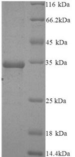 SDS-PAGE