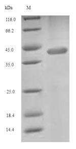 SDS-PAGE