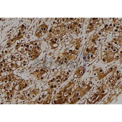 Валидация Affinity DF4111 - 15404