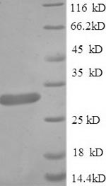 SDS-PAGE
