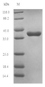 SDS-PAGE