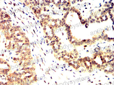 Валидация AntibodySystem RHJ44002