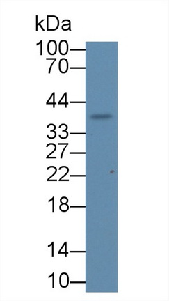 17635