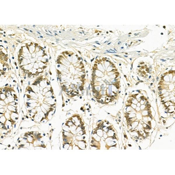 Валидация Affinity DF3491 - 14408