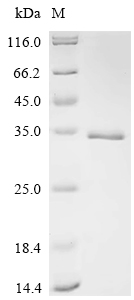 SDS-PAGE