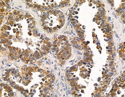 Валидация Affinity DF14818 - 10925