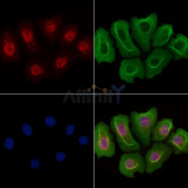 Валидация Affinity DF2417 - 13018
