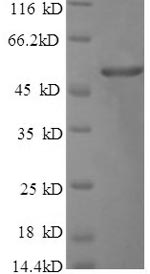 SDS-PAGE