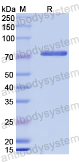 YZZ01101, SDS-PAGE