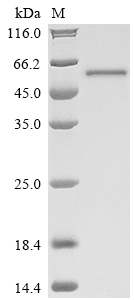 SDS-PAGE