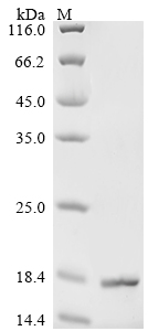 SDS-PAGE