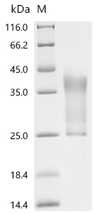 SDS-PAGE
