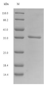 SDS-PAGE