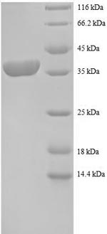SDS-PAGE