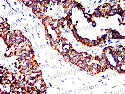 Валидация AntibodySystem RHC38801 (992)