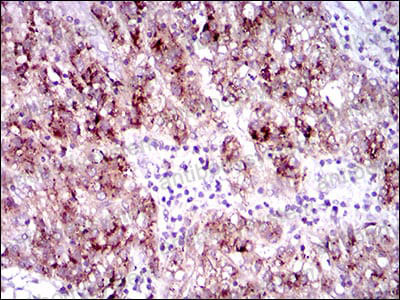 Валидация AntibodySystem RHE19102