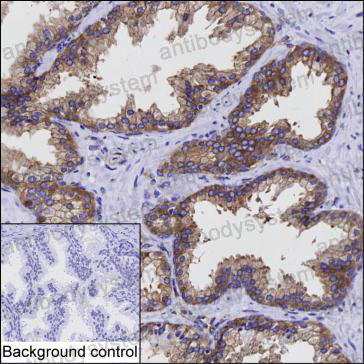 Валидация AntibodySystem RHB83503