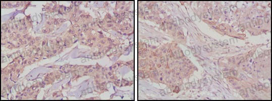 Валидация AntibodySystem RHE72103