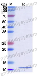 YWK14901, SDS-PAGE