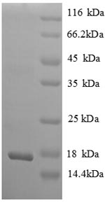 SDS-PAGE