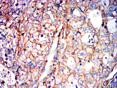 Валидация AntibodySystem RHC12102 (643)