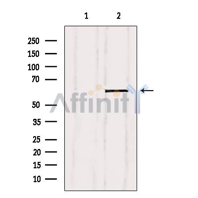 Валидация Affinity AF6113 - 3324