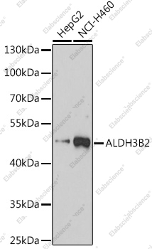 Вестерн-блоттинг, ALDH3B2, различные клеточные линии