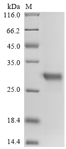 SDS-PAGE