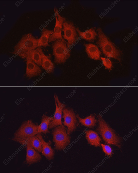 Иммунофлуоресценция, TAK1, клетки PC-12