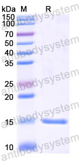 Валидация SDS-PAGE - AntibodySystem RHE07602