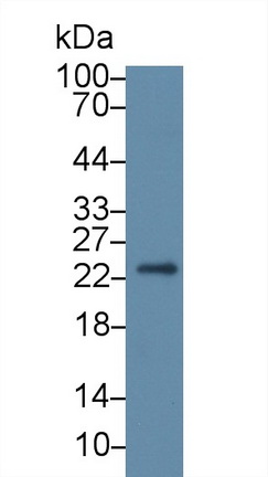 14751