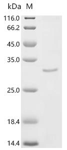 SDS-PAGE