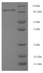 SDS-PAGE