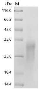 SDS-PAGE