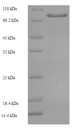 SDS-PAGE