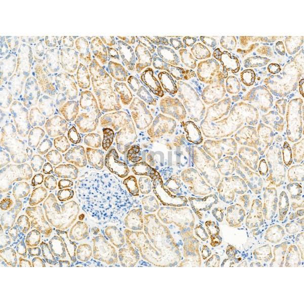 Валидация Affinity DF13377 - 8625