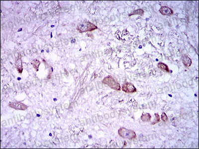 Валидация AntibodySystem RHC91702
